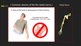 Radial Nerve