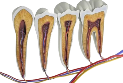 dent11